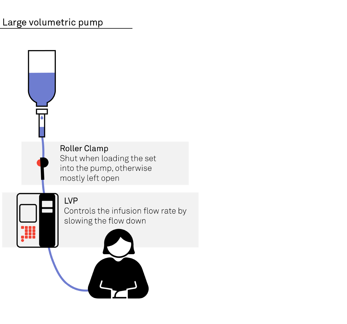 Volumetric Pump Diagram | Medical Device Consulting | Team Diagram of how a large volumetric pump works