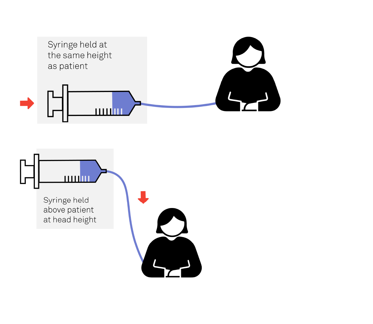 Syringe Pump Diagram | Medical Device Consulting | Team Diagram of how a syringe pump works