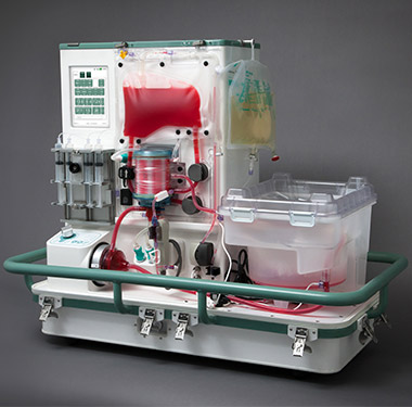 OrganOx metra medical device development