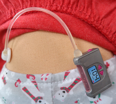 doll with model insulin pump on waist band