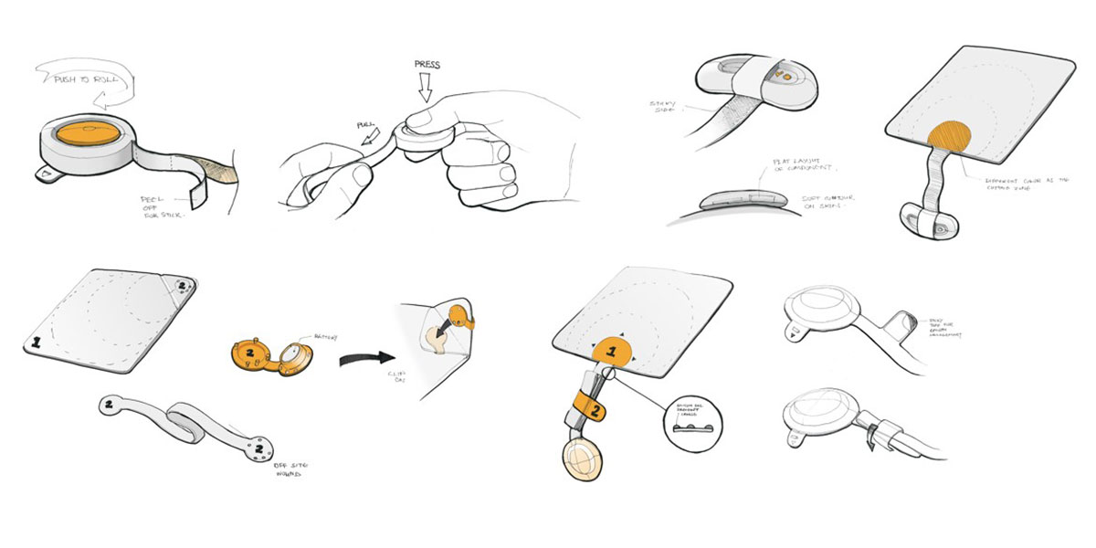 woundcare-device-product-development-sketches