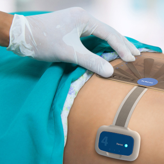 Doctor hand close gauze on Cesarean Section wound. abdominal