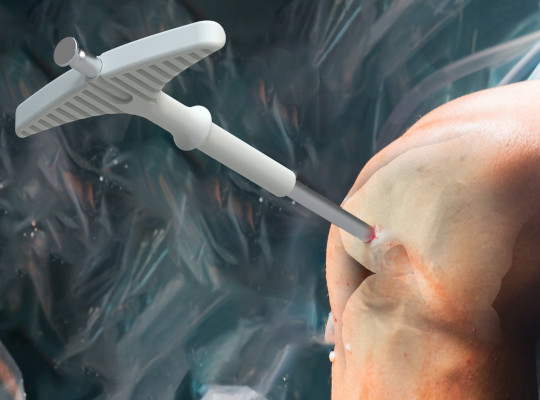 surgical device and knee joint