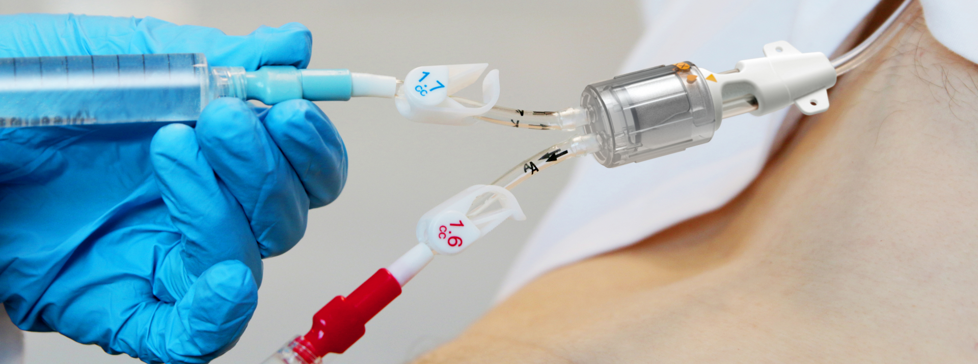 Central Venous Catheter in Use | Team Consulting