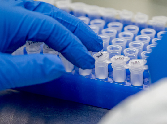 blue gloved hand with sample vials