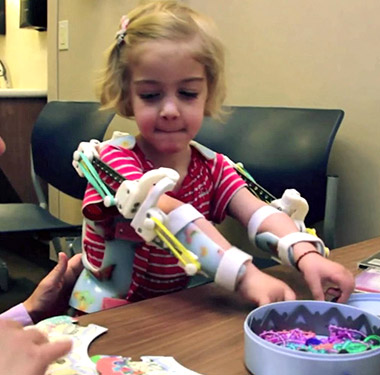 Rapid parts and magic arms