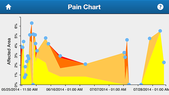 shin-splints-pain-chart