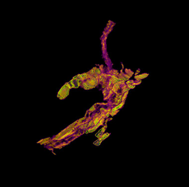 3D imaging of needle free injection