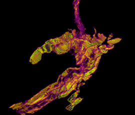 3D imaging of needle free injection