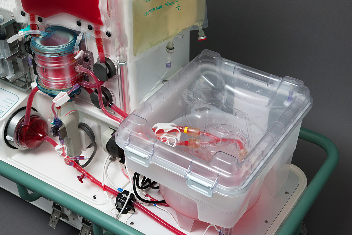 OrganOx Metra tested