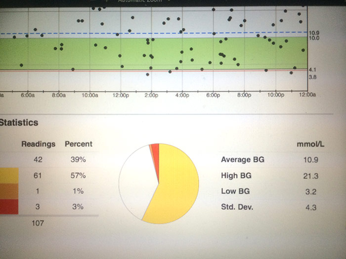 t1d-tipping-scales